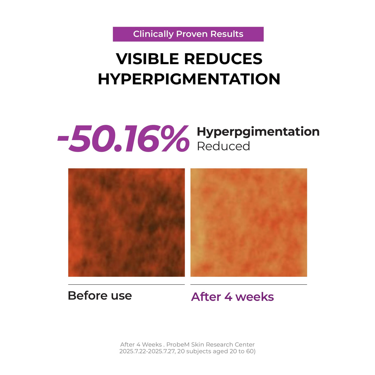 JUMISO before and after tone comparison highlighting brighter-looking skin results