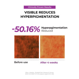 JUMISO before and after tone comparison highlighting brighter-looking skin results
