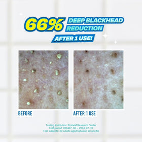 JUMISO dual-ended swabs close-up for gentle wipe and lift