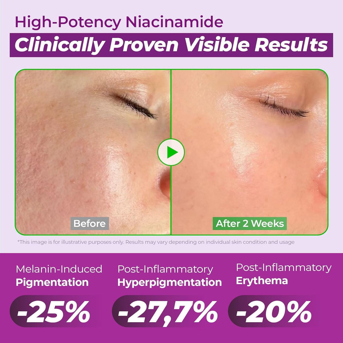 JUMISO serum on face lifestyle image showing refined pores and glass skin