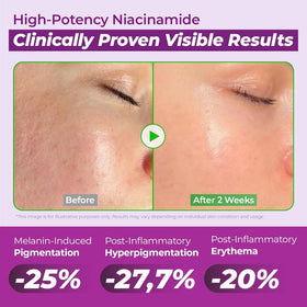 JUMISO serum on face lifestyle image showing refined pores and glass skin