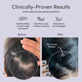Jupiter scalp mask texture close-up foam demonstrating gentle exfoliating foam and smooth consistency