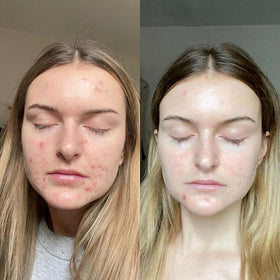 K6 Skin Care applying a pea-sized amount on fingertip for dosing