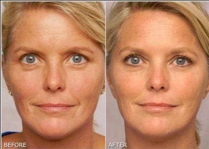 K6 Skin Care gel in nighttime routine setting promoting skin renewal