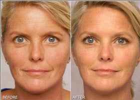 K6 Skin Care gel in nighttime routine setting promoting skin renewal