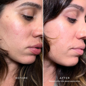 Karuna goji berry close-up depicting antioxidant support for brighter skin