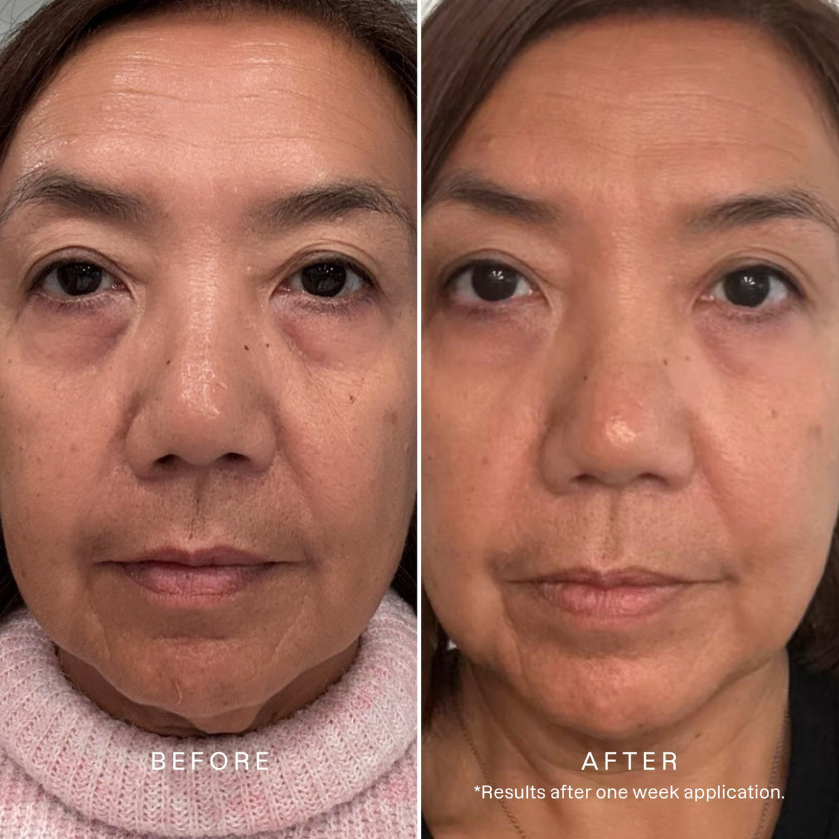 Karuna serum droplet on skin showing lightweight texture and quick absorption