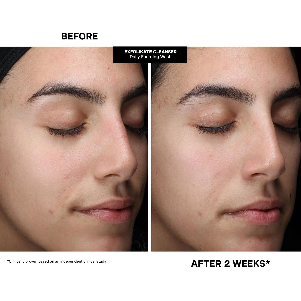 Kate Somerville kit contents laid flat showing three cleansers for varied needs