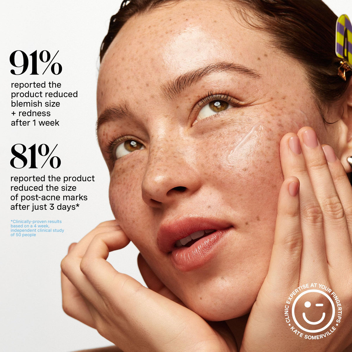 Kate Somerville product on fingers demonstrating targeted spot application