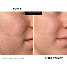 Kate Somerville treatment being dispensed into hand for quick application