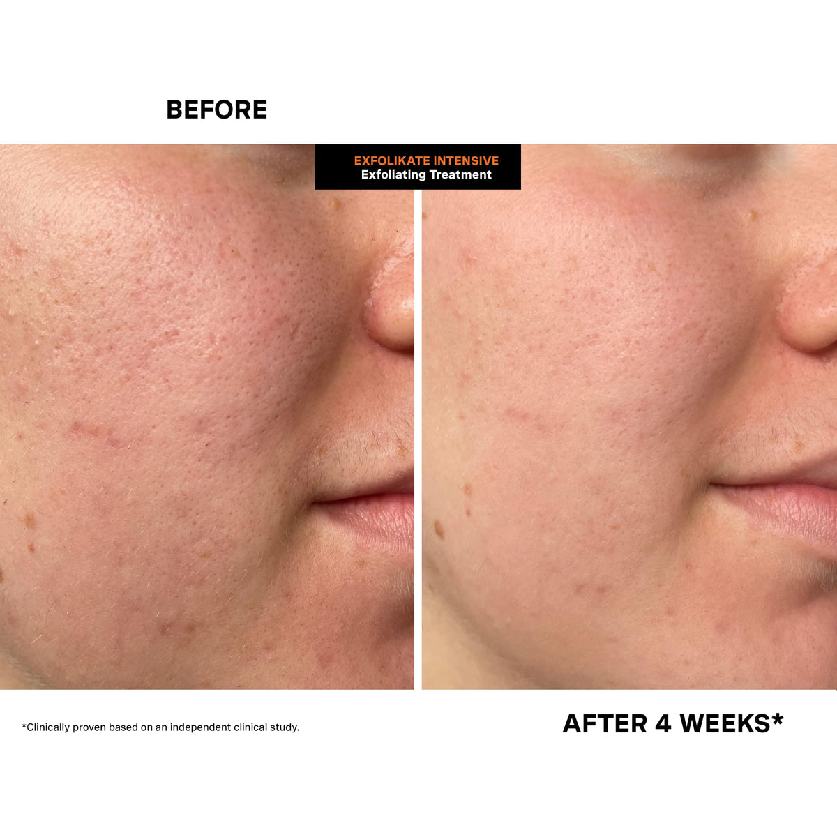 Kate Somerville ingredients flatlay with acids and botanicals for clearer pores