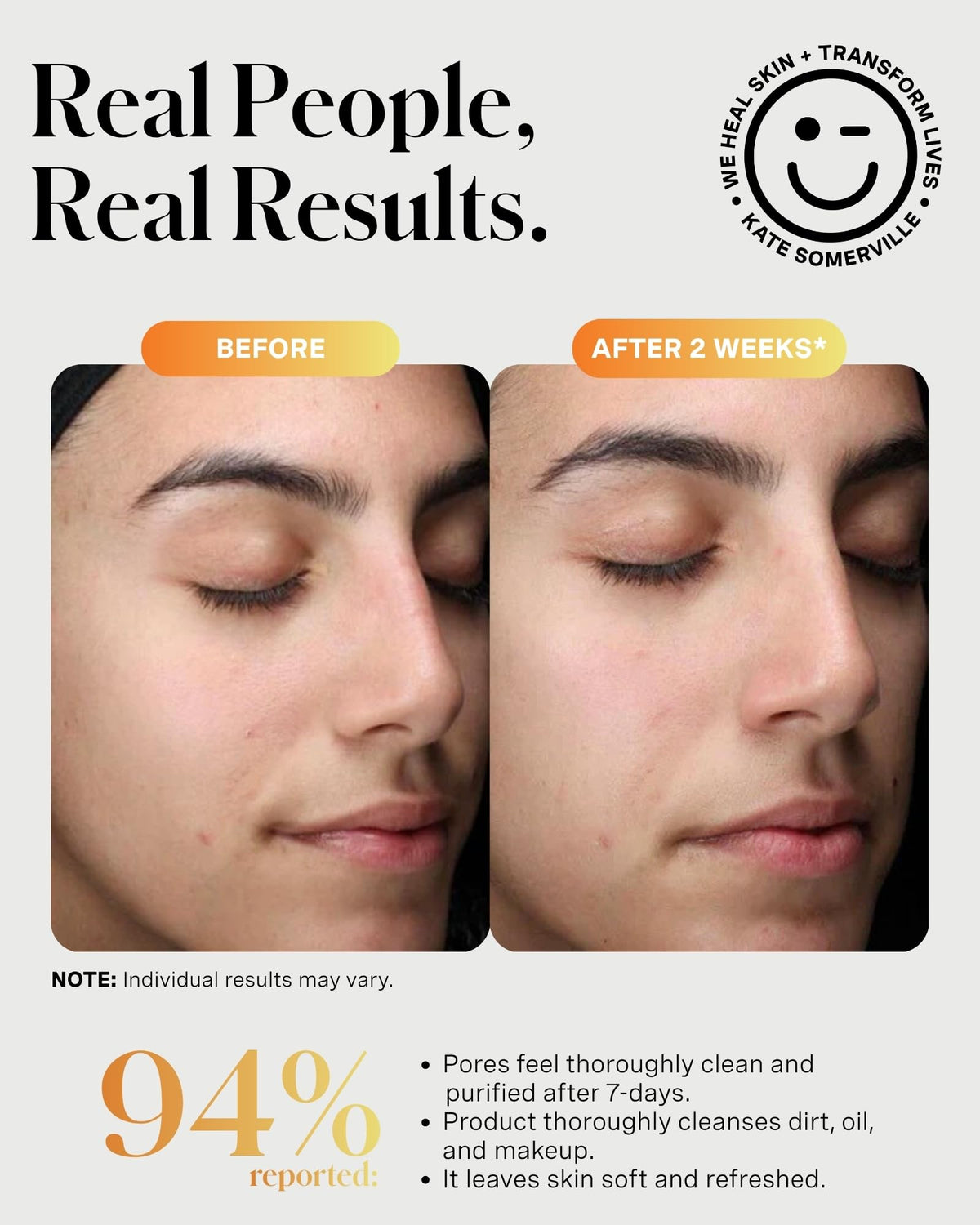 Kate Somerville product label close-up showing active ingredients benefit