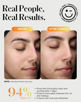 Kate Somerville product label close-up showing active ingredients benefit