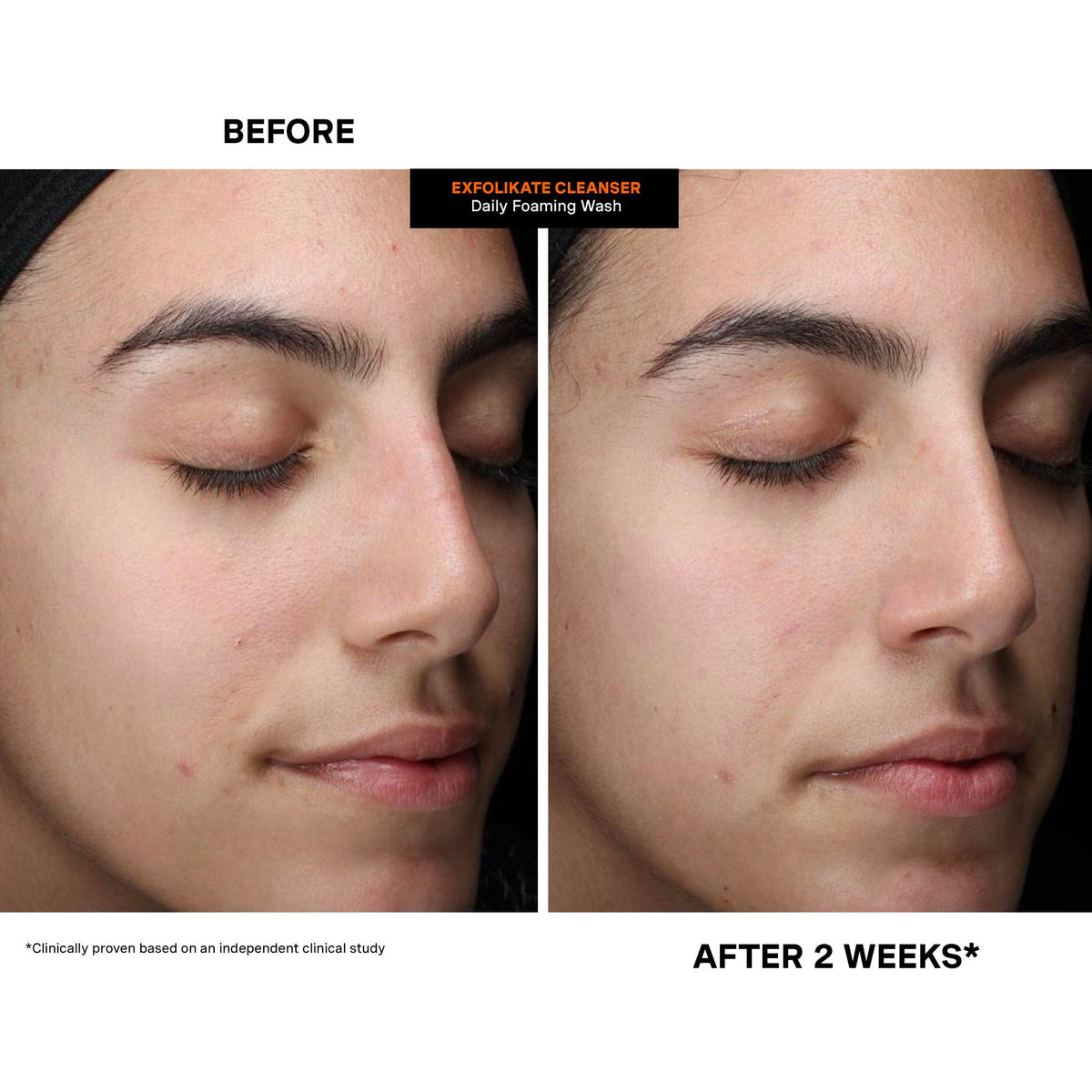 Kate Somerville flatlay with complementary products supporting routine integration benefit