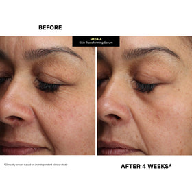 Kate Somerville serum on bathroom counter with skincare items showing everyday routine benefit