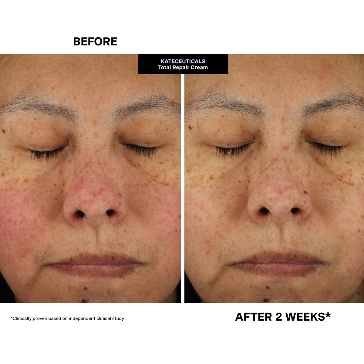 Kate Somerville layering cream over serum showing compatibility and absorption