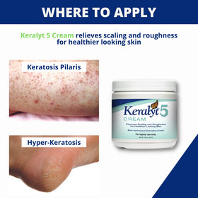 Keralyt 5 label and ingredient list highlighting active 5% salicylic acid