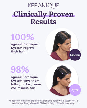 Keranique application on scalp demonstrating precise targeted use