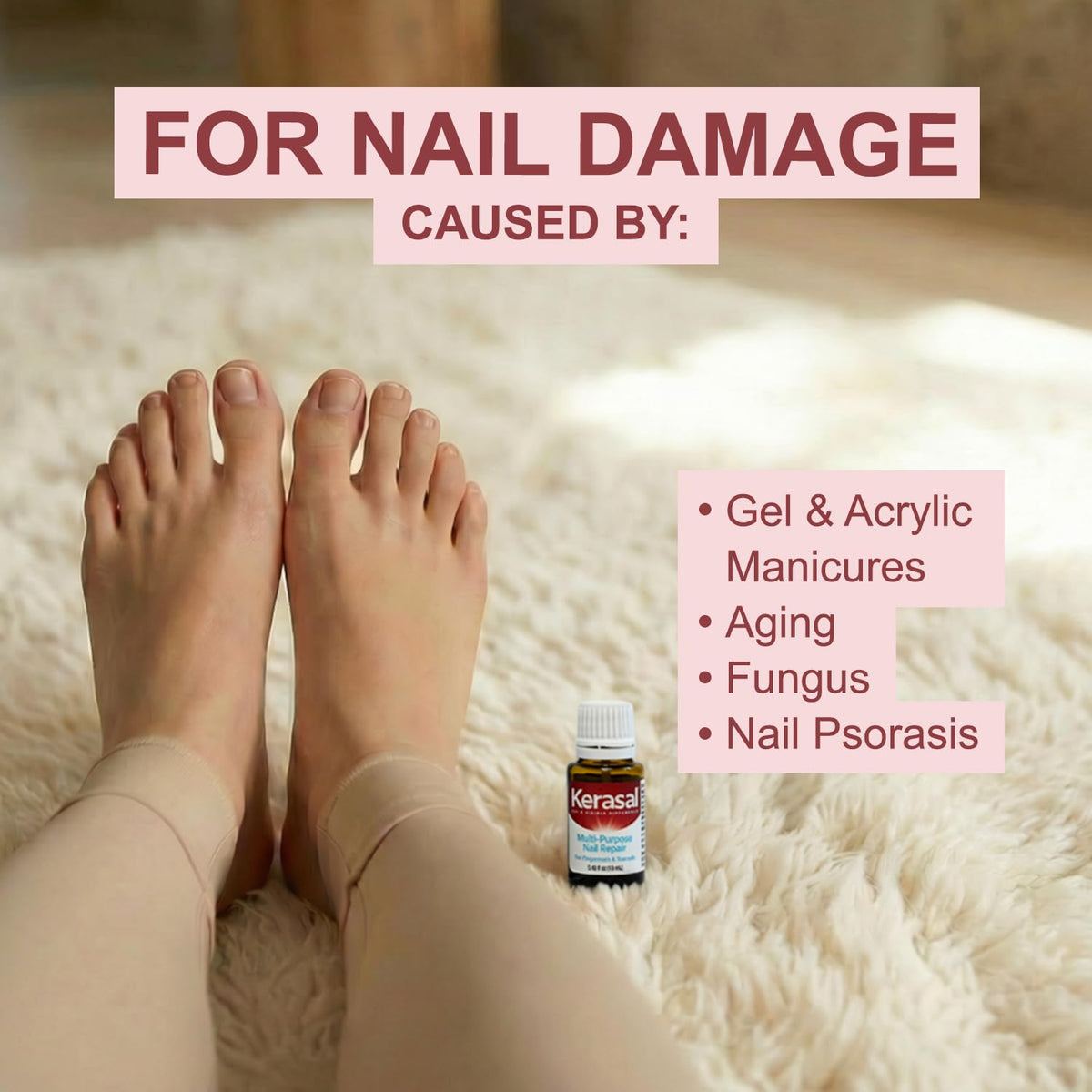 Kerasal before and after nails comparison showing improved appearance