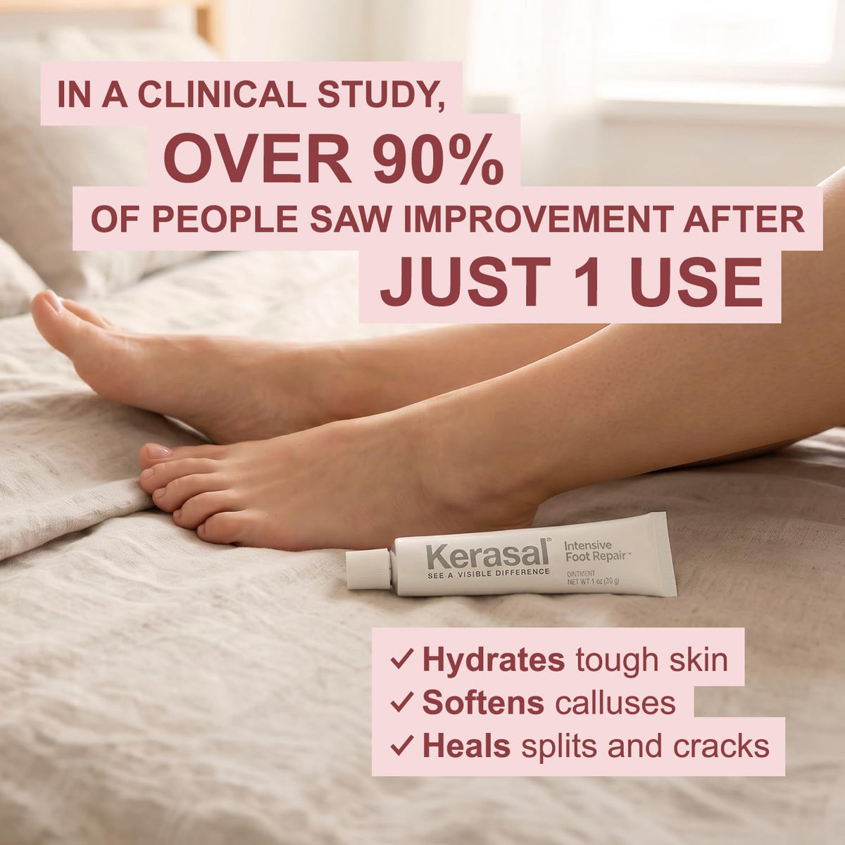 Kerasal ointment applied to heel in use to enhance skin smoothing