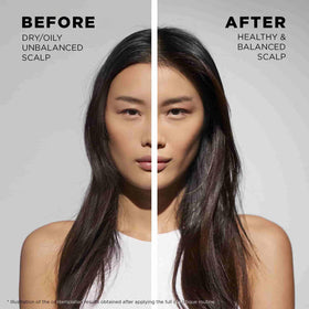 KÉRASTASE product being applied to scalp showing targeted relief benefit