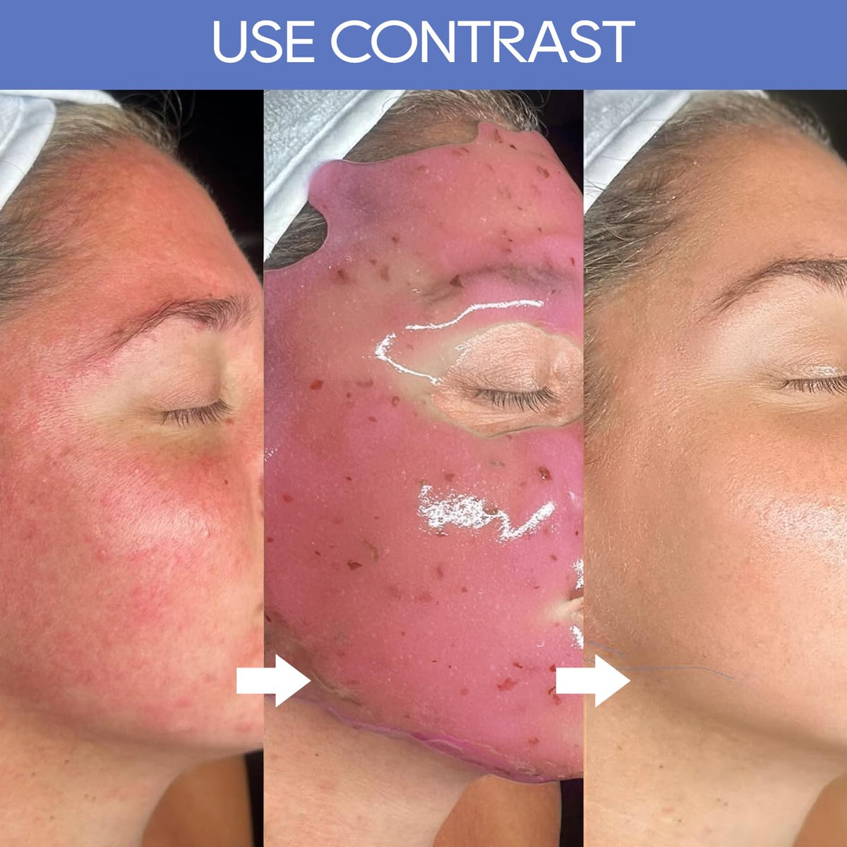 KERUILA application on face illustrating even coverage and full contour fit