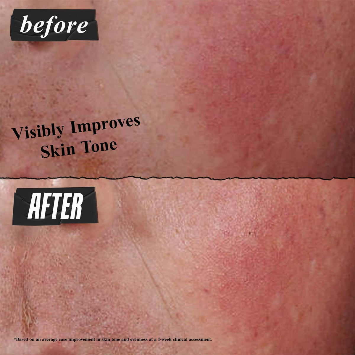 Kiehl's beta-glucan ingredient visual highlighting barrier-repair hydration benefit