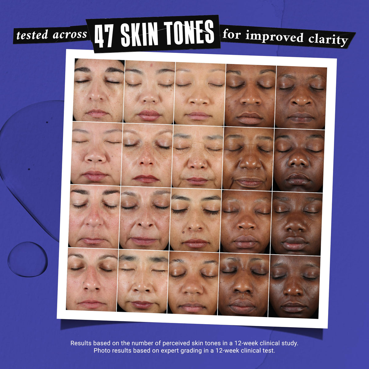 Kiehl's application on cheek as spot treatment showing targeted use
