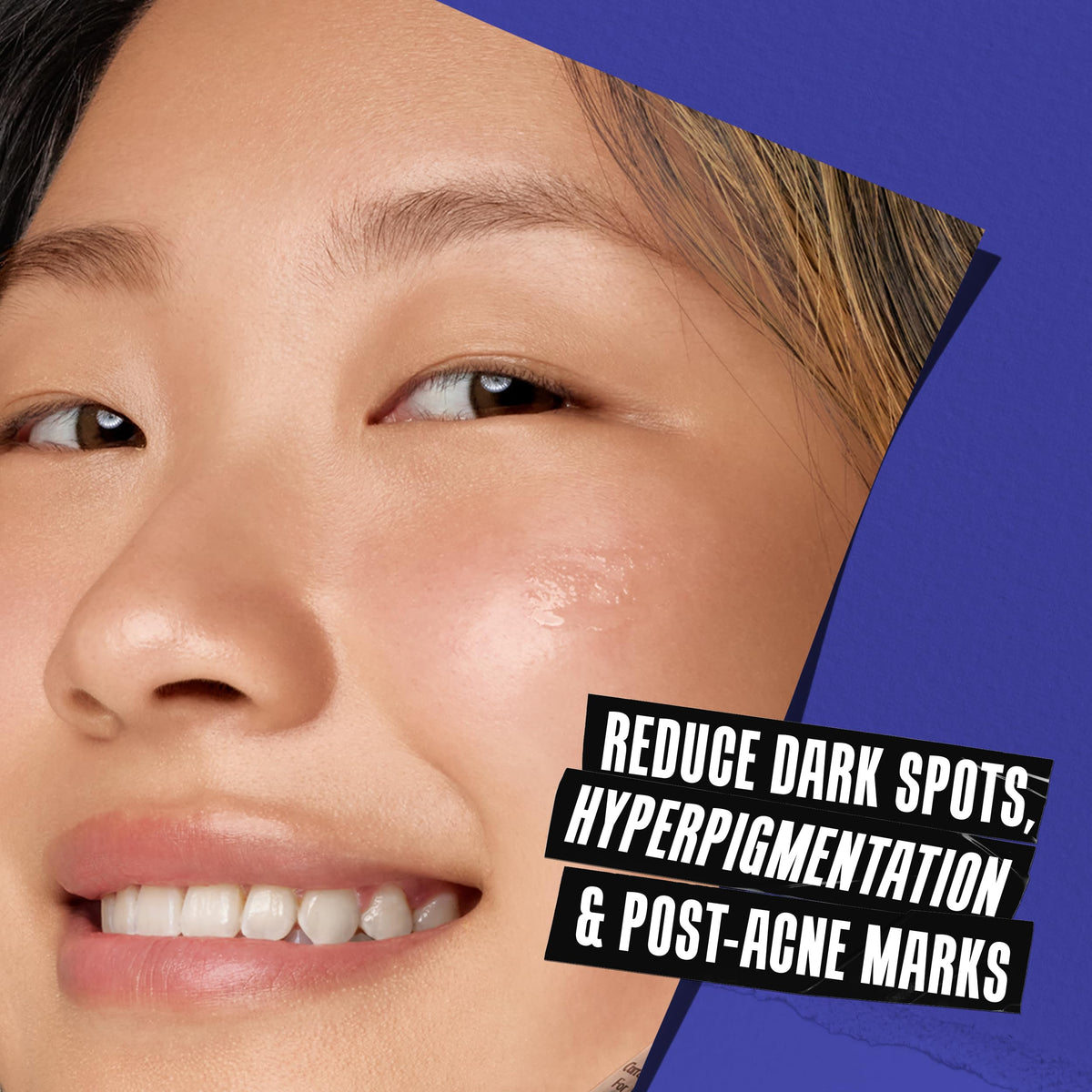 Kiehl's before and after comparison revealing brighter, even tone