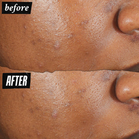 Kiehl's invisible dry film on skin demonstrating discreet coverage
