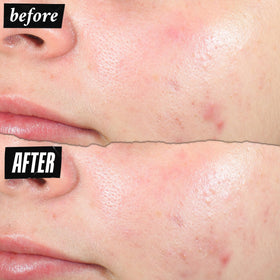 Kiehl's ingredient callout with salicylic acid visual for clarity