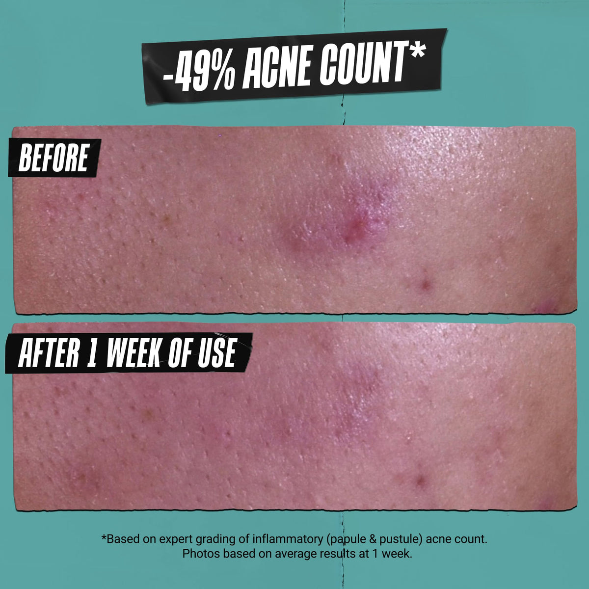 Kiehl's mask applied to damp skin showing deep-cleaning use and mattifying benefit