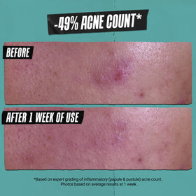 Kiehl's mask applied to damp skin showing deep-cleaning use and mattifying benefit
