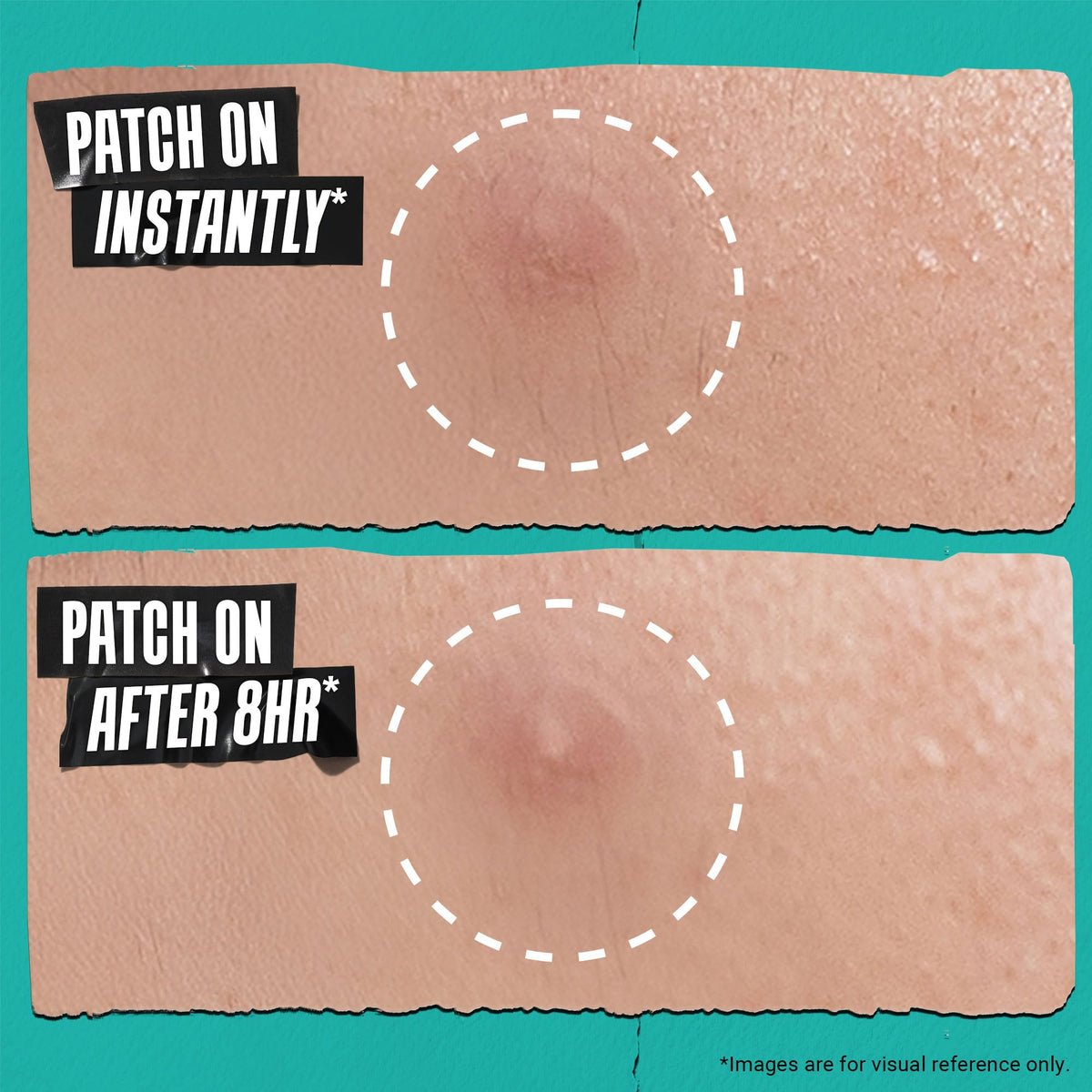 Kiehl's patch worn during sleep in bedroom showing overnight flattening aid