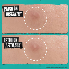 Kiehl's patch worn during sleep in bedroom showing overnight flattening aid