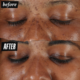 Kiehl's serum texture close-up showing lightweight, non-greasy finish