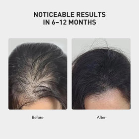 KINTOR spray nozzle close-up for precise scalp application benefit