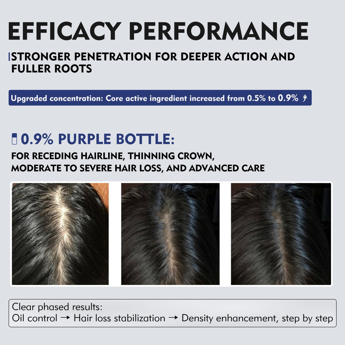 KINTOR sprayer nozzle detail for precise, measured scalp application