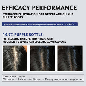 KINTOR sprayer nozzle detail for precise, measured scalp application