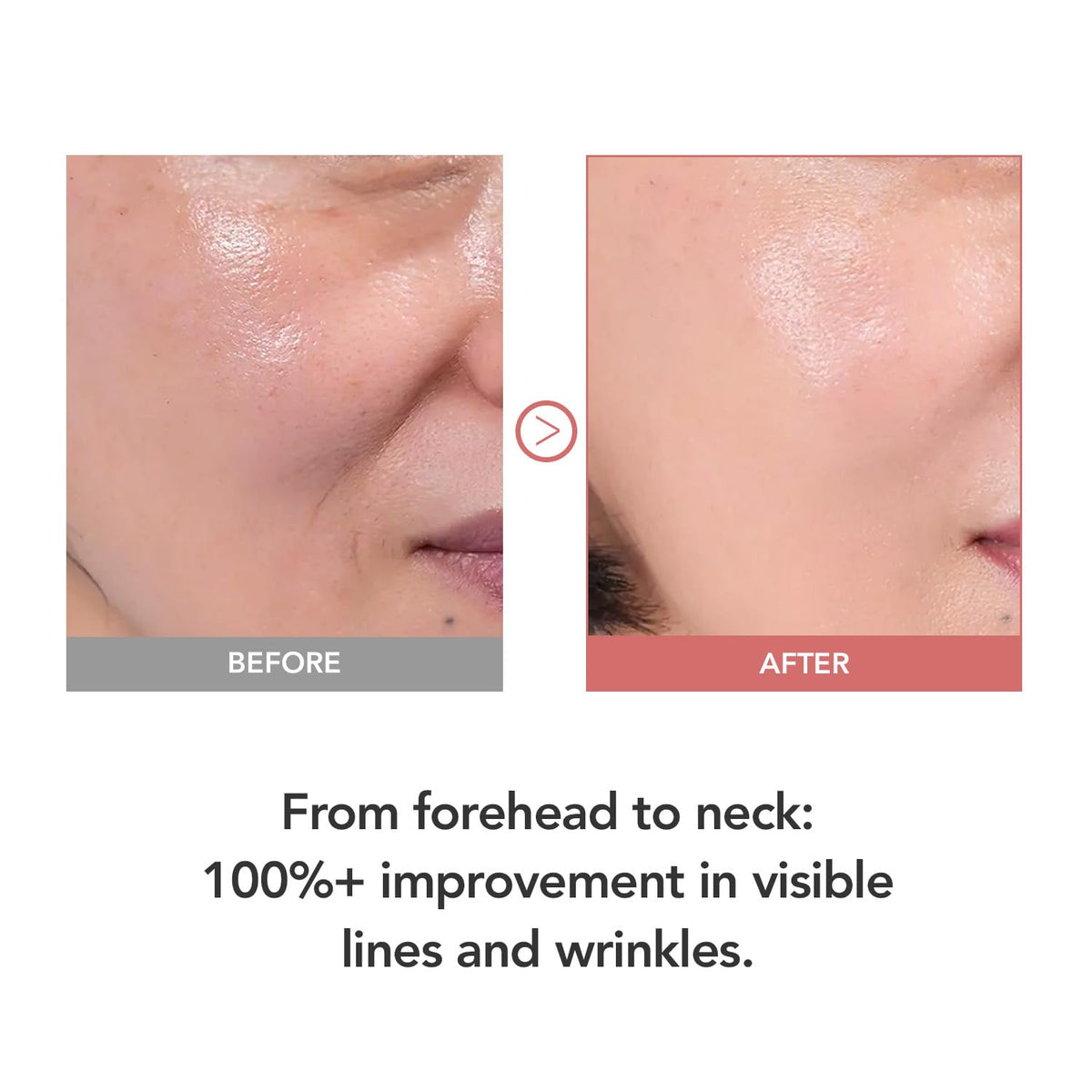 KIOSKIN applying stick to eye area for reduced crow’s feet appearance