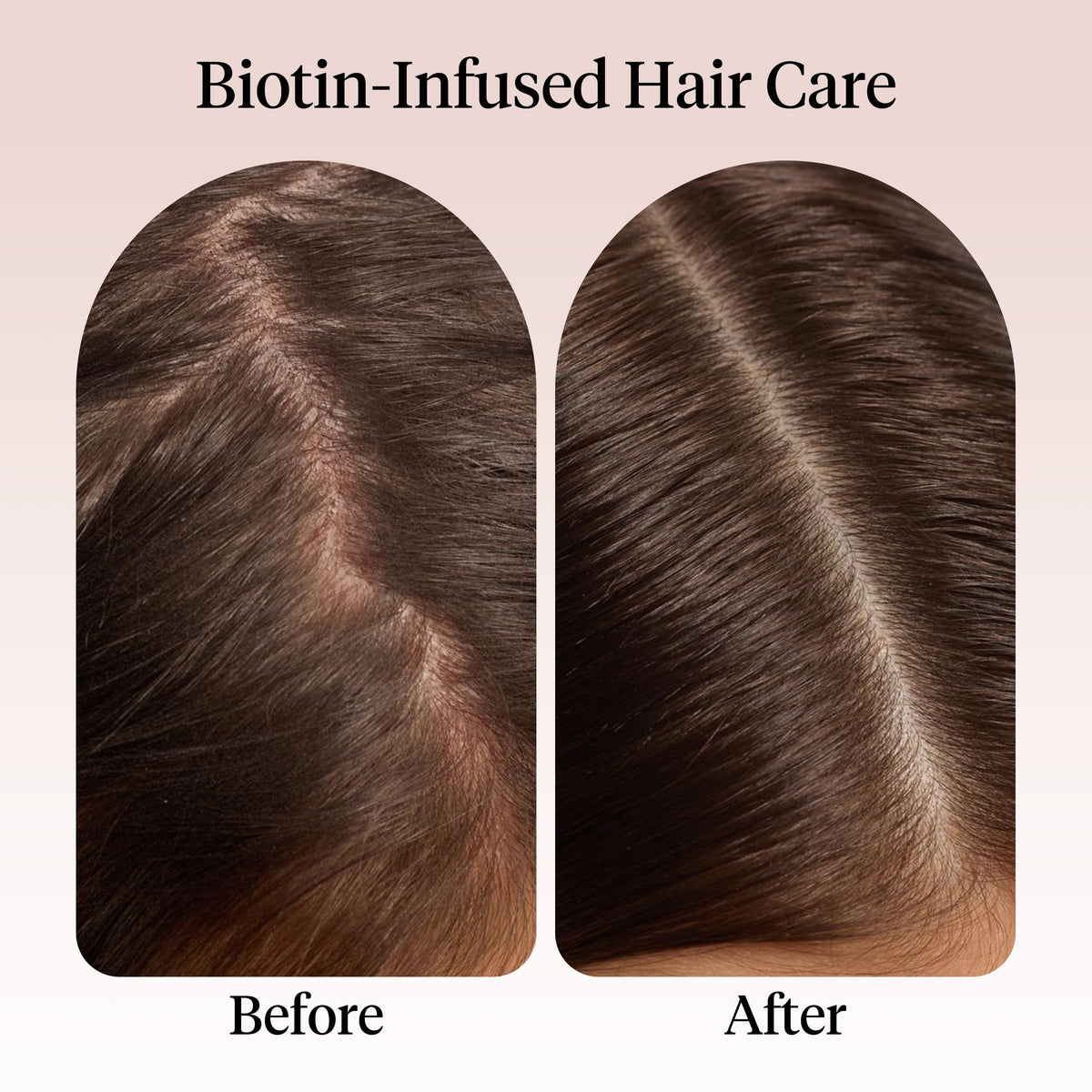 Kitsch applying oil to scalp demonstrating massage technique for improved comfort