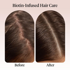 Kitsch applying oil to scalp demonstrating massage technique for improved comfort