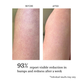 klarifyScience ingredient label close-up highlighting acids and calming actives