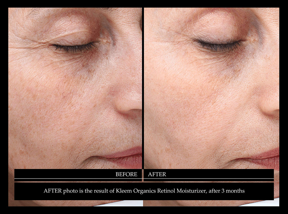 Kleem night vanity scene showing product in evening skincare ritual