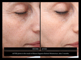 Kleem night vanity scene showing product in evening skincare ritual