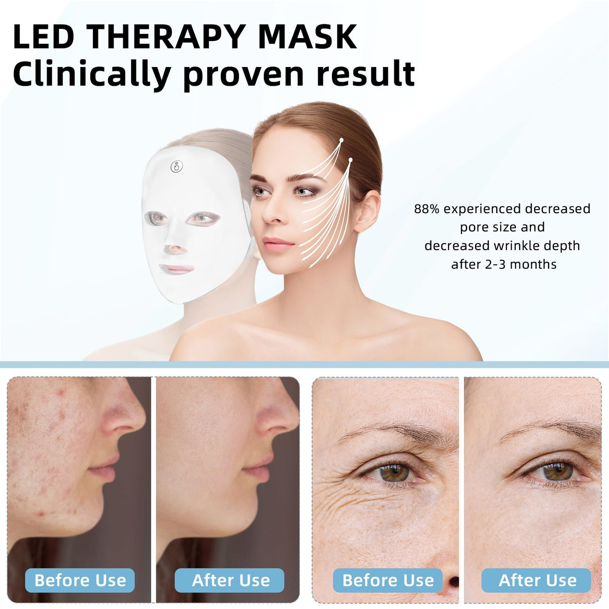 KNNKNN mask in use on model illustrating hands-free at-home skin treatment