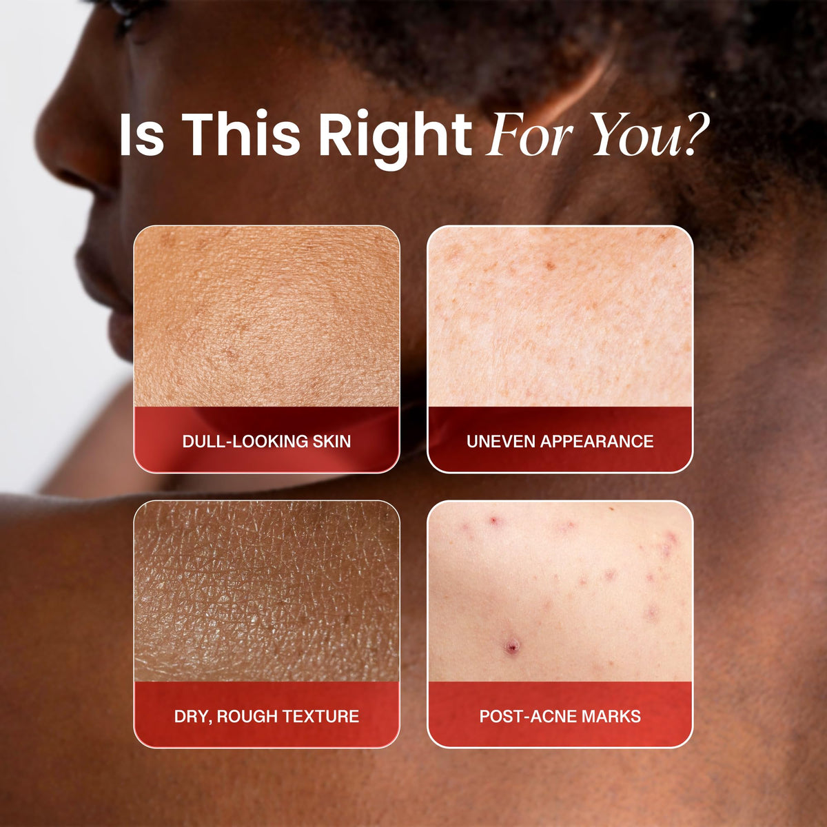 Koji White lotion texture close-up highlighting smooth, fast-absorbing finish