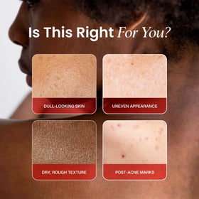 Koji White lotion texture close-up highlighting smooth, fast-absorbing finish