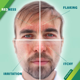 KOPA HAIKU being applied to cheek to soothe flakes and reduce tightness