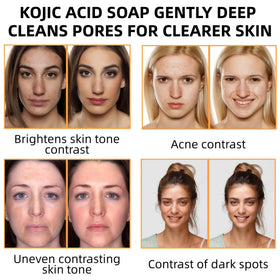 KORA BALM ingredients label displaying kojic acid, turmeric and actives